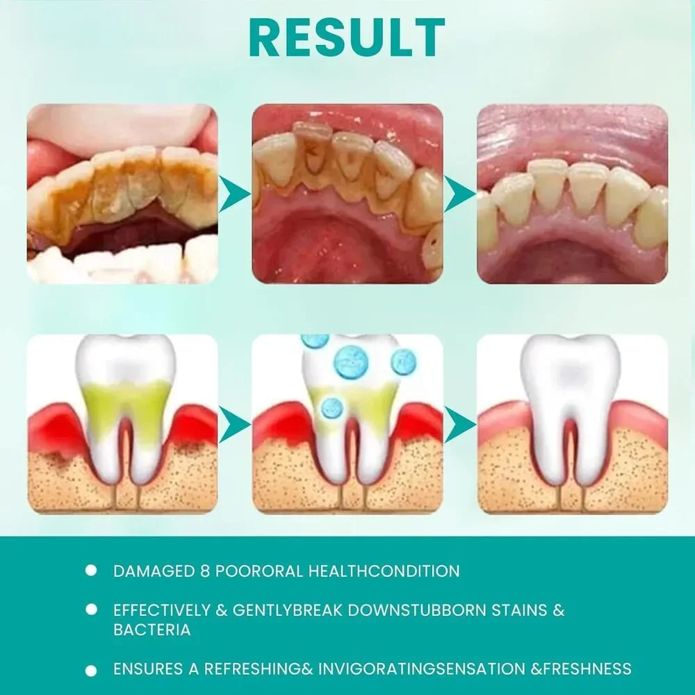 2pcs Sp6 Probiotic Whitening Toothpaste, Sp-6 Ultra Whitening, Fresh Breath - Picture 6 of 7